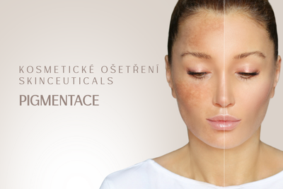 Dermokosmetické ošetření – Pigmentace