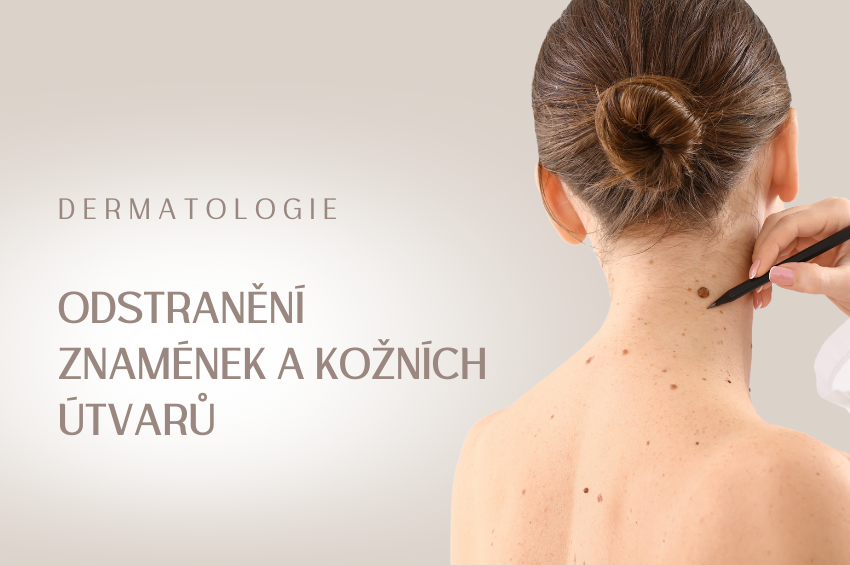Mateřská znaménka a kožní útvary – odstranění