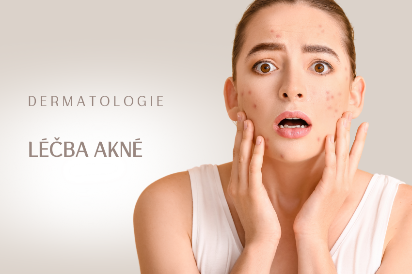 Akné – léčba
