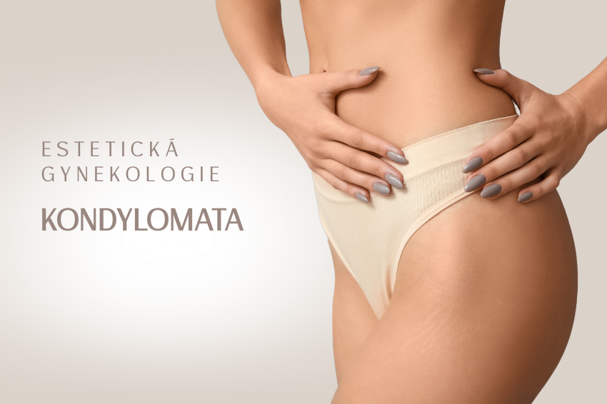 Kondylomata